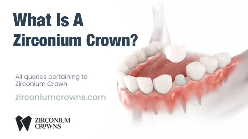 What Is A Zirconium Crown?