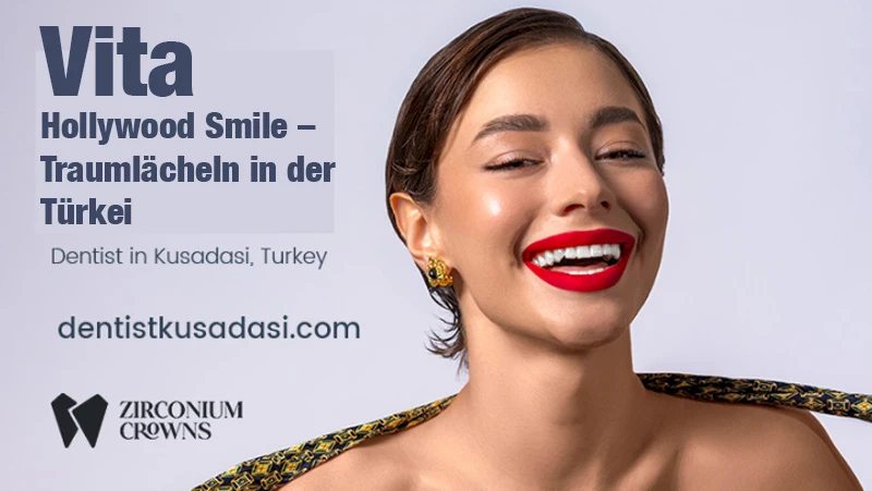 Vita Hollywood Smile – Ihr Traumlächeln in der Türkei