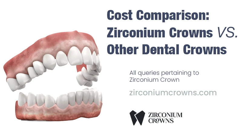 Cost Comparison: Zirconium Crowns vs. Other Dental Crowns