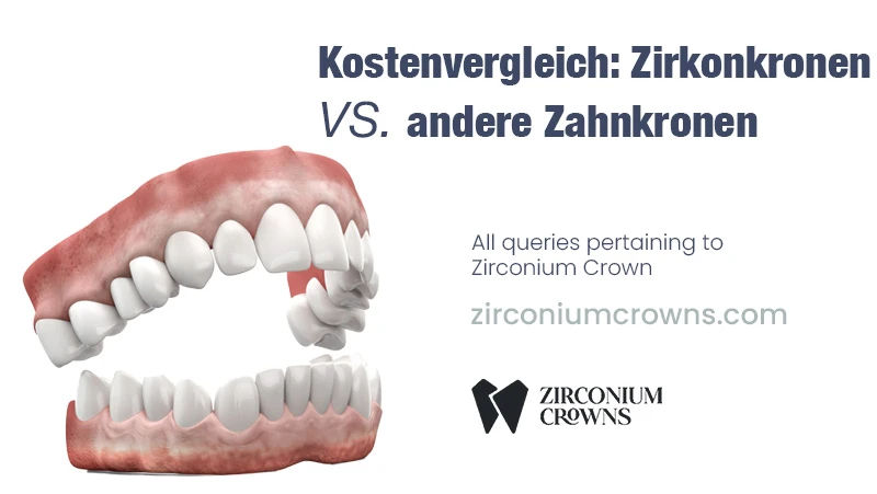 Kostenvergleich: Zirkonkronen vs. andere Zahnkronen
