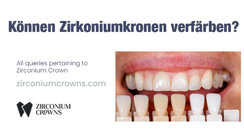 Können Zirkoniumkronen verfärben?