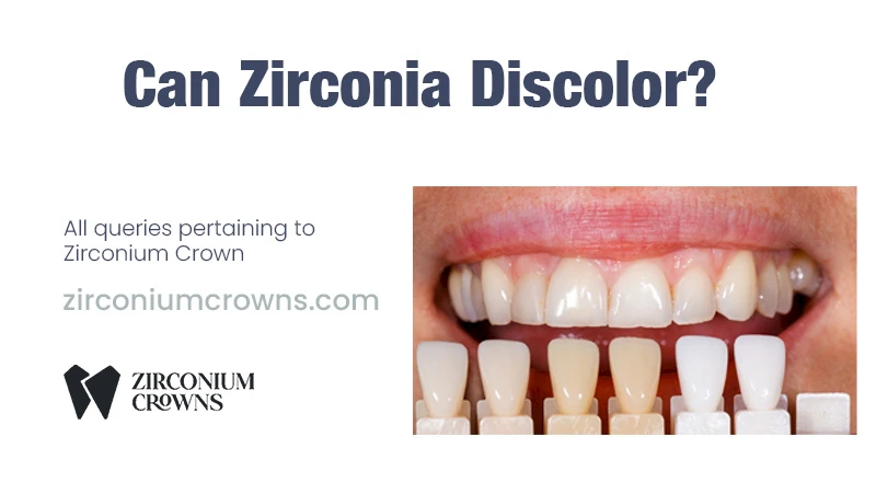 Can Zirconia Discolor?