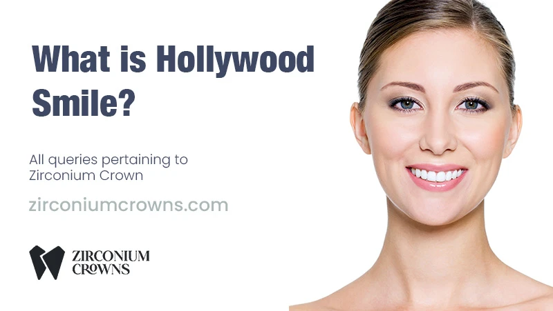 Understanding the Hollywood Smile: What It Is and Why It’s Popular
